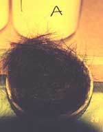 Hair viewed through 550 nm high pass (orange) filter and room light