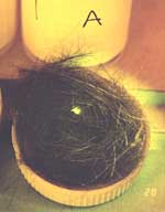 Hair viewed through 550 nm high pass (orange) filter and blue light illumination