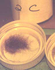 Hair viewed through 550 nm high pass (orange) filter and room light