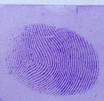 Fingerprint on adhesive side of tape, developed with Gentian Violet