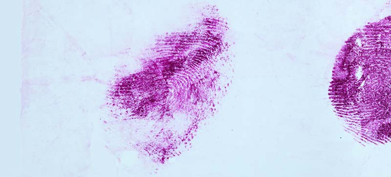 BVDA - Staining traces