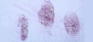 Fingerprints in blood on steel can after staining with Crowle's stain.